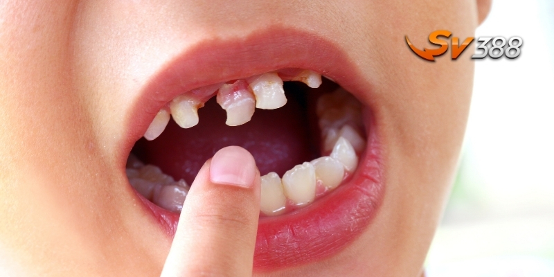 Giải mã giấc mơ rụng răng liệu có mang điềm xui